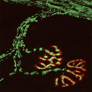 REAS Neuroimaging