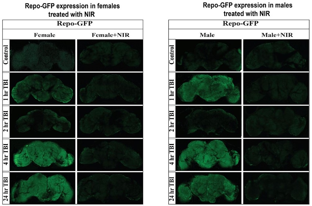 Near-Infrared Light Modulation of Cytochrome C Oxidase Downregulates Gene Transcription After Traumatic Brain Injury