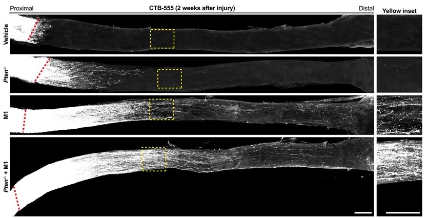 Neuroscientists identify a small molecule that restores visual function after optic nerve injury