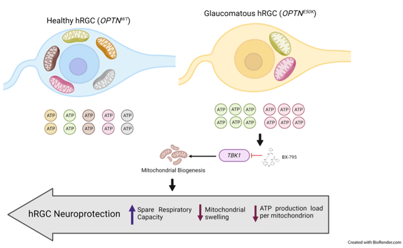 Researchers discover therapeutic target to aid in glaucoma treatment