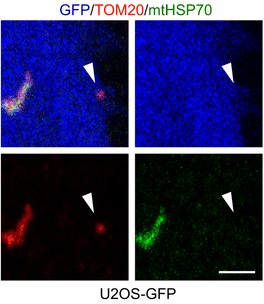 Selective-inclusion-of-mitochondrial-proteins-in-EVs-a-EV-markers-were-analysed-by