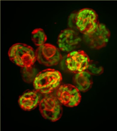 Therese Kichuk Best Mitochondria Image