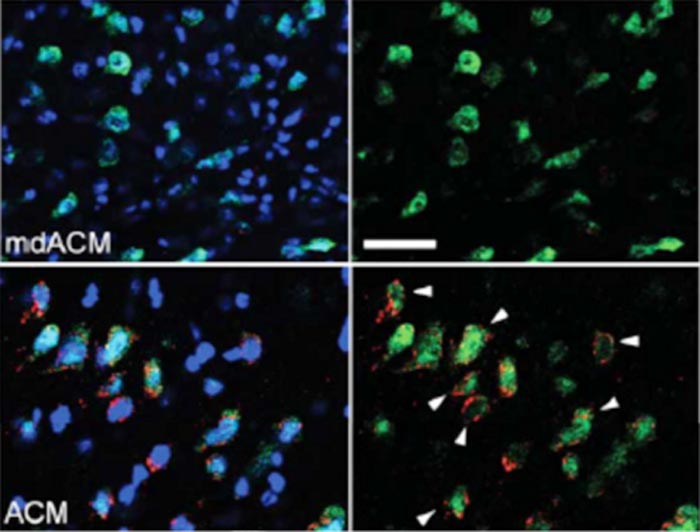 Transplantation of Astrocytic Mitochondria for Intracerebral Hemorrhage Treatment