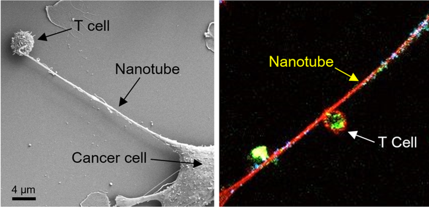 cancer cells