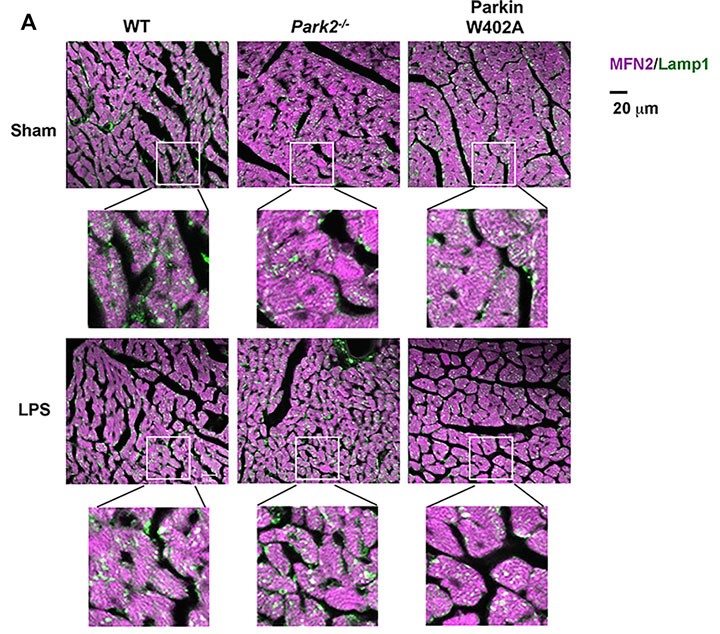 Parkin in the Regulation of Myocardial Mitochondria-Associated Membranes and Cardiomyopathy During Endotoxemia