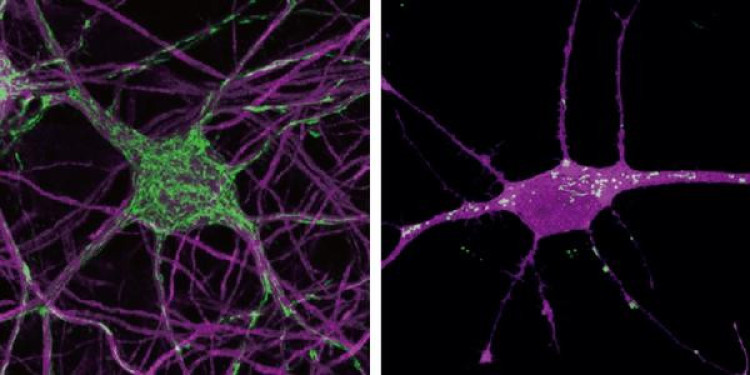 inline large mouse-human-neurons-vib