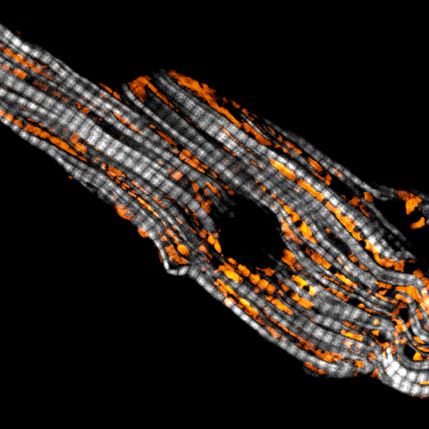 Mitochondria