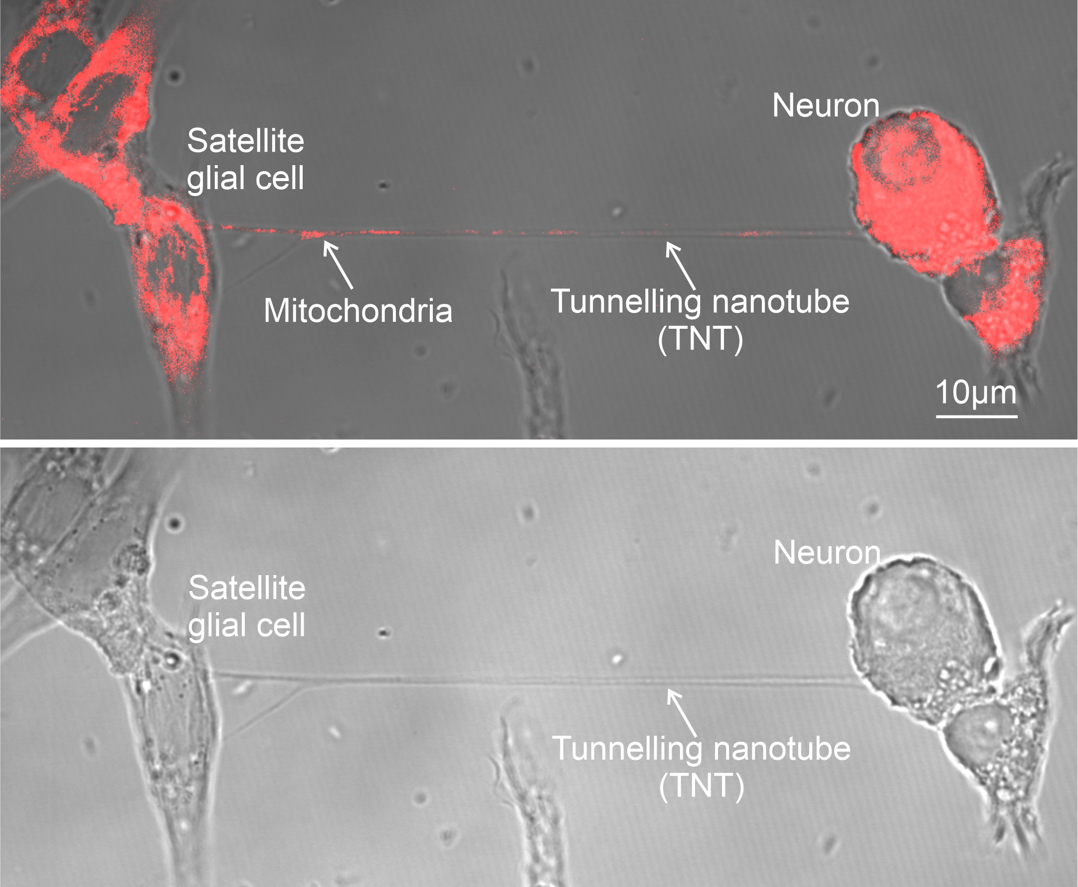 Cells share mitochondria to protect nerves from pain When cells share mitochondria, nerve pain can be reduced