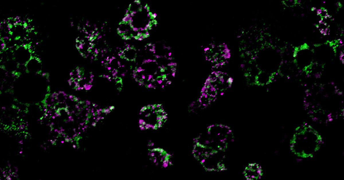 mitochondrial-networks-teaser-1200x628