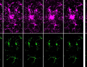 Sugar first, mitochondria later: how brain immune cells respond to injury